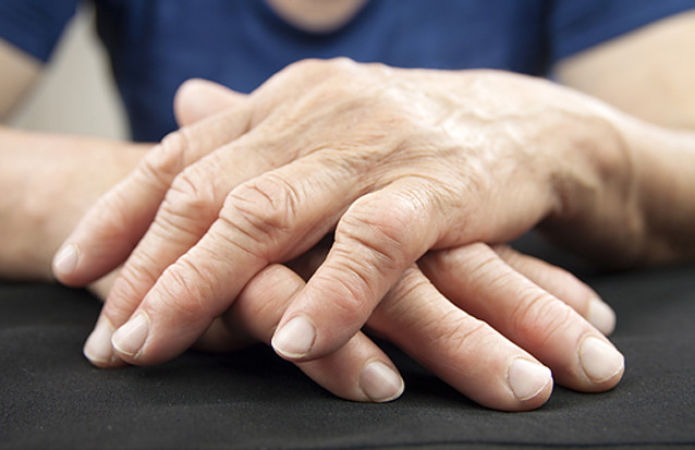 Photo of elderly hands
